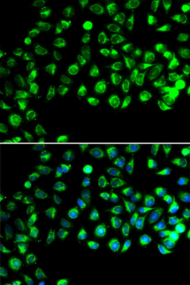 GTL3 Antibody in Immunocytochemistry (ICC/IF)