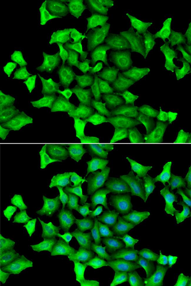 SLA/LP Antibody in Immunocytochemistry (ICC/IF)