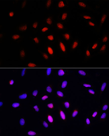 COMMD1 Antibody in Immunocytochemistry (ICC/IF)