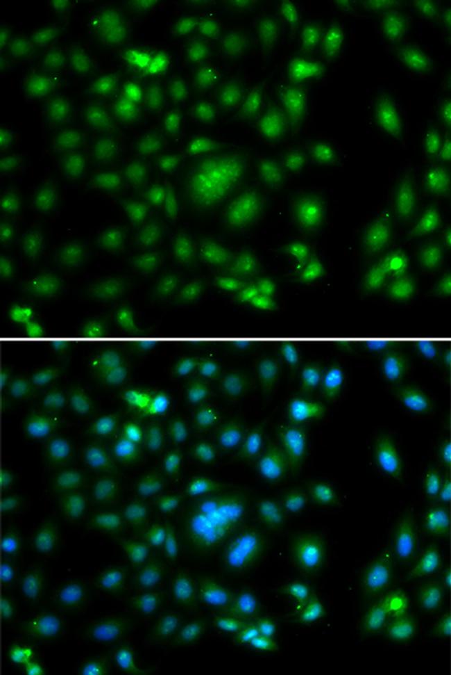 ELF5 Antibody in Immunocytochemistry (ICC/IF)