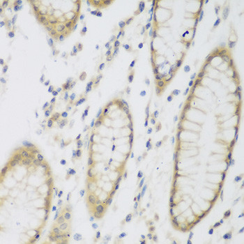 NAT8B Antibody in Immunohistochemistry (Paraffin) (IHC (P))