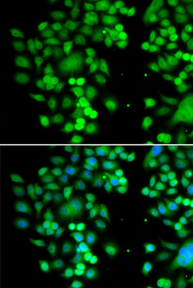 PHYHD1 Antibody in Immunocytochemistry (ICC/IF)