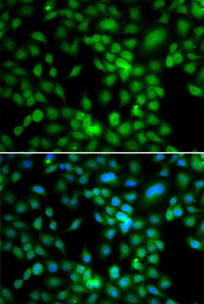 SYCE1 Antibody in Immunocytochemistry (ICC/IF)