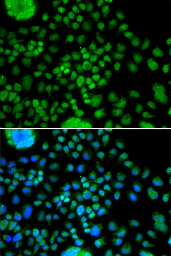 ATOH7 Antibody in Immunocytochemistry (ICC/IF)