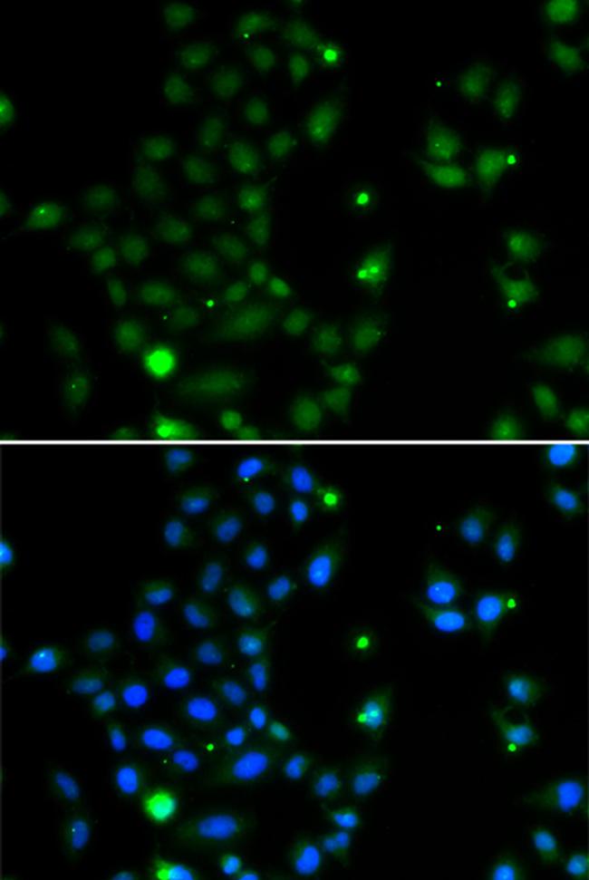 GCM1 Antibody in Immunocytochemistry (ICC/IF)