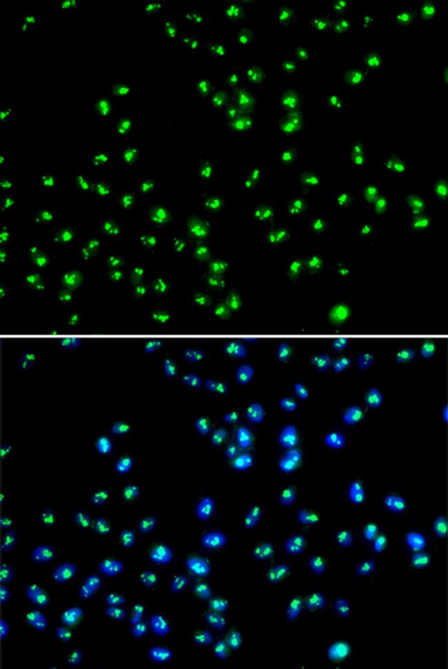 NAT10 Antibody in Immunocytochemistry (ICC/IF)