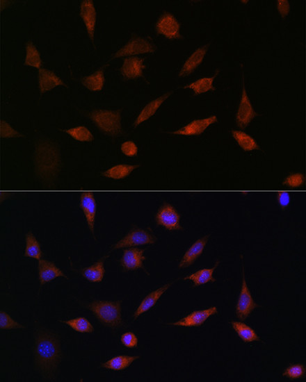 PDCD5 Antibody in Immunocytochemistry (ICC/IF)