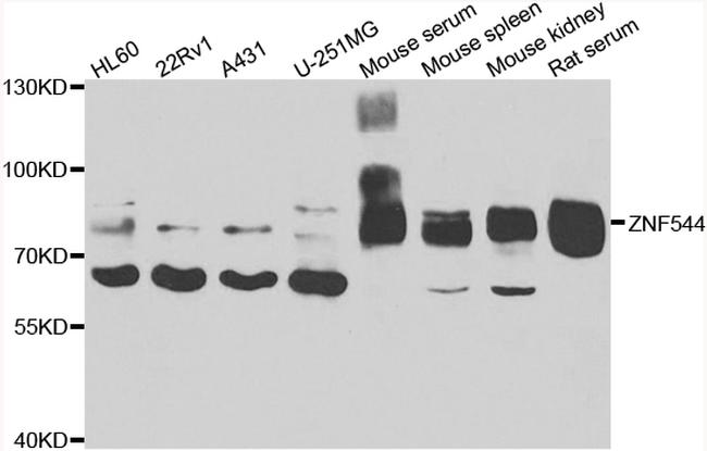 ZNF544 Antibody in Western Blot (WB)