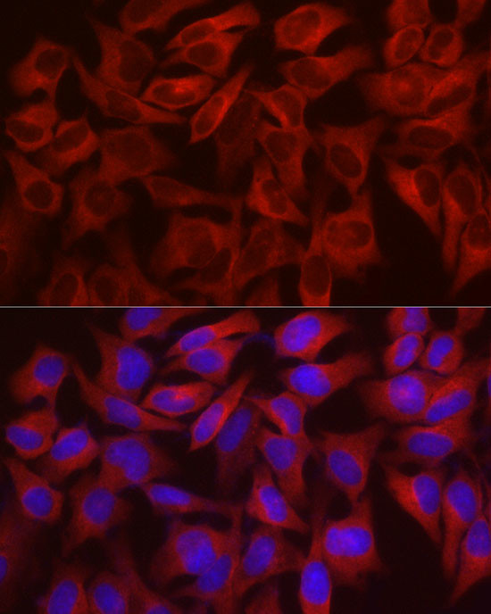 WISP2 Antibody in Immunocytochemistry (ICC/IF)