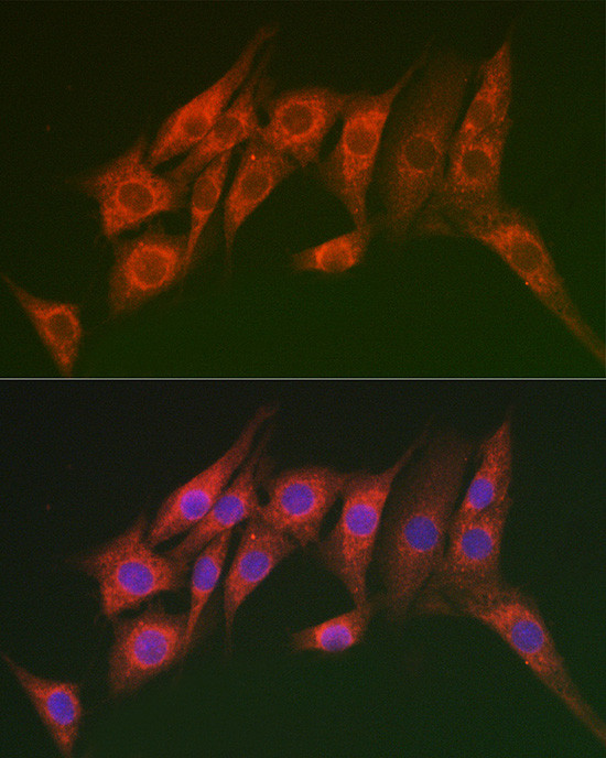 MTMR14 Antibody in Immunocytochemistry (ICC/IF)