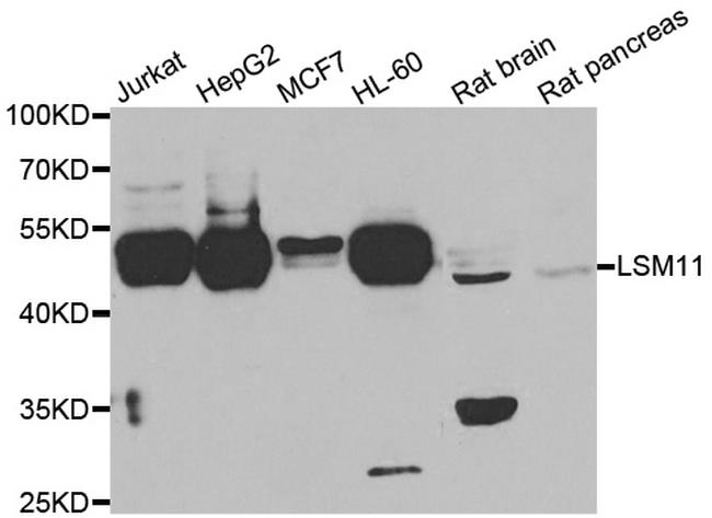 LSM11 Antibody in Western Blot (WB)