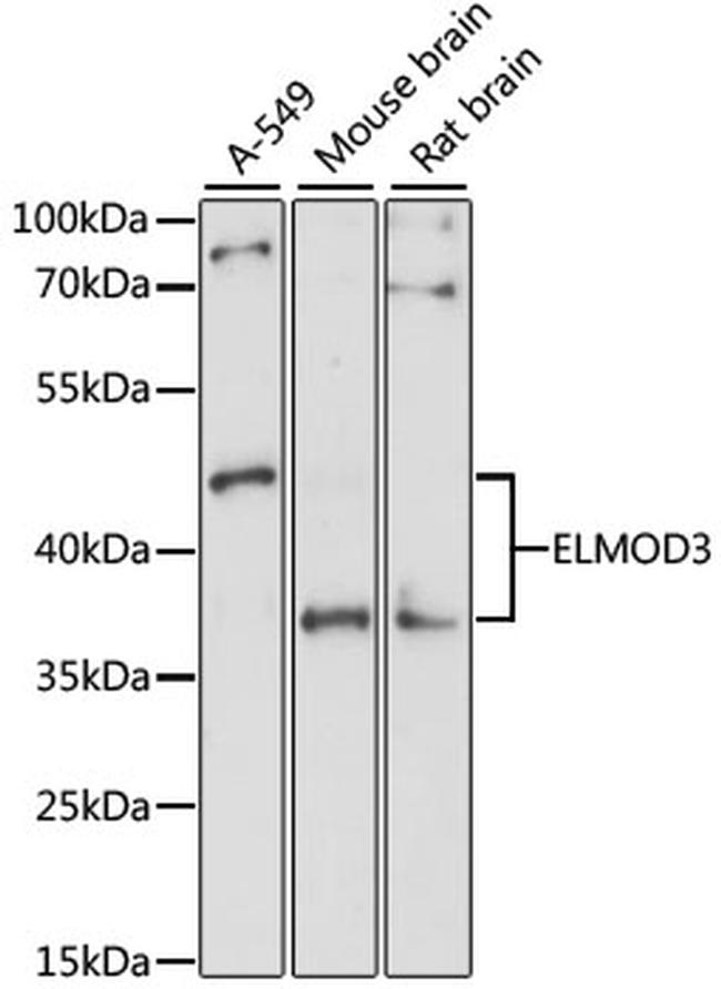 ELMOD3 Antibody in Western Blot (WB)