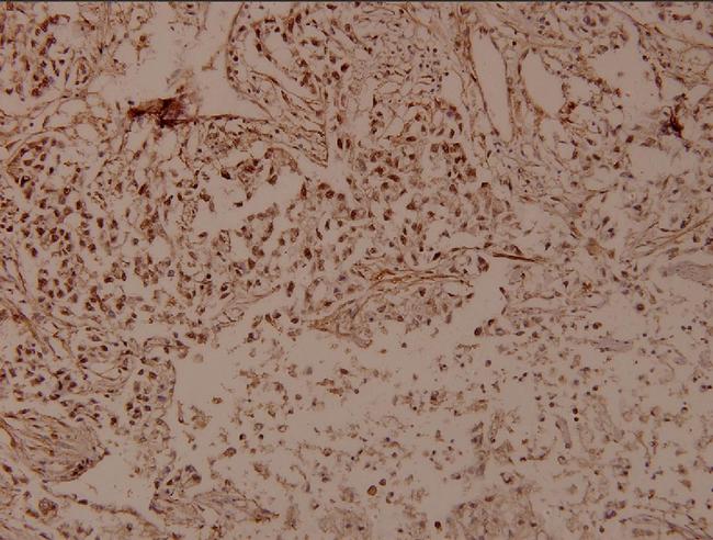 THOC5 Antibody in Immunohistochemistry (Paraffin) (IHC (P))