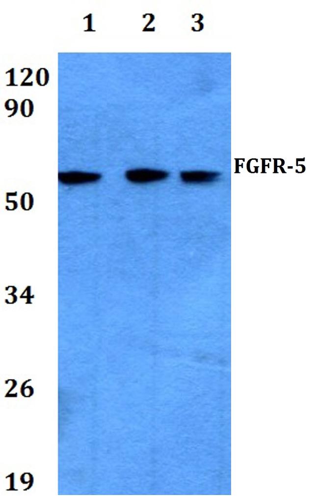 FGFR5 Antibody in Western Blot (WB)