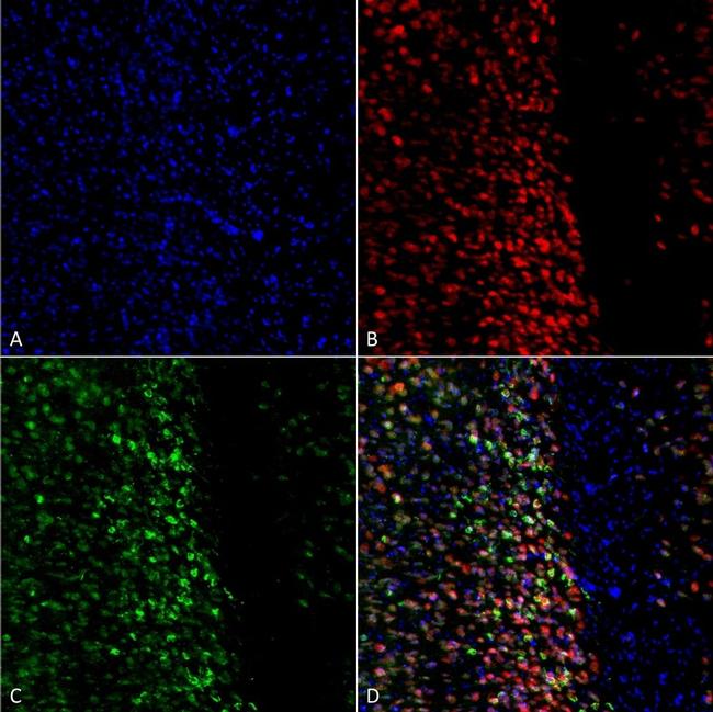 Phospho-alpha Synuclein (Ser129) Antibody in Immunocytochemistry (ICC/IF)