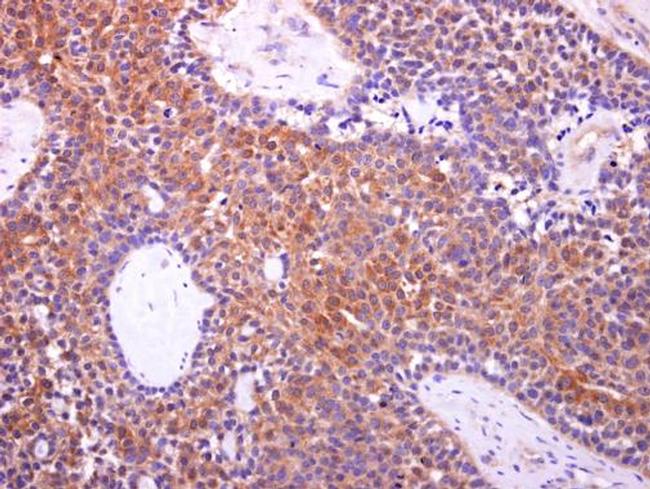 Aconitase 1 Antibody in Immunohistochemistry (Paraffin) (IHC (P))