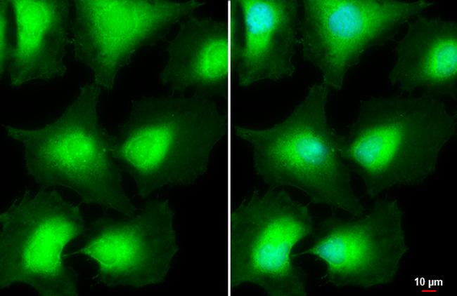 AKT Pan Antibody in Immunocytochemistry (ICC/IF)