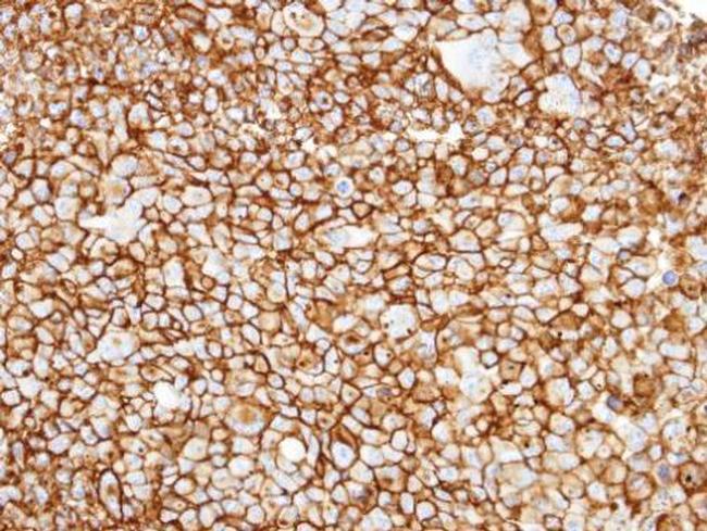 CD13 Antibody in Immunohistochemistry (Paraffin) (IHC (P))