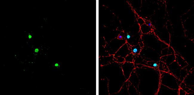 ASCL1 Antibody in Immunocytochemistry (ICC/IF)