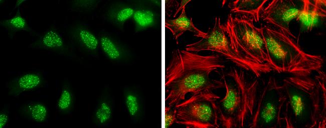 Phospho-ATR (Thr1989) Antibody in Immunocytochemistry (ICC/IF)