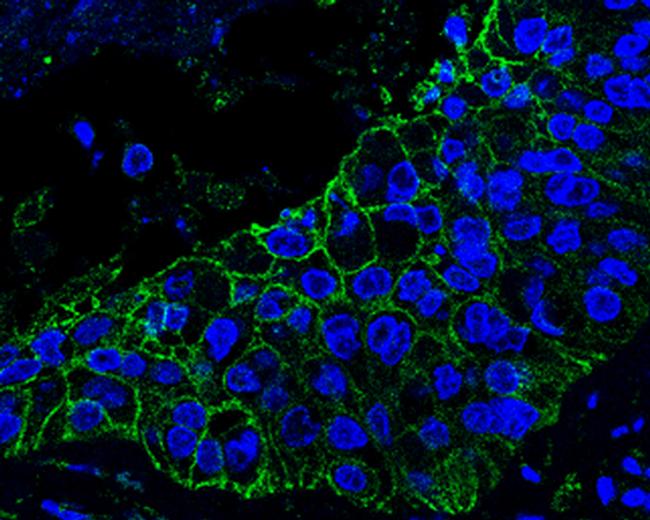 Axl Antibody in Immunohistochemistry (Paraffin) (IHC (P))