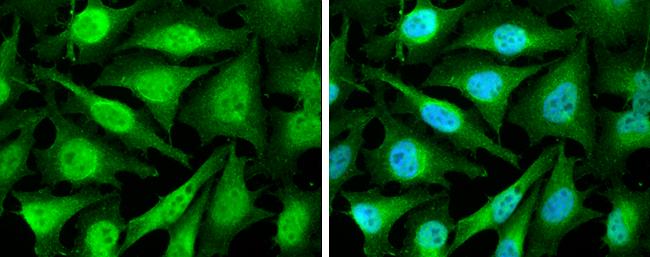 Cyclin D2 Antibody in Immunocytochemistry (ICC/IF)