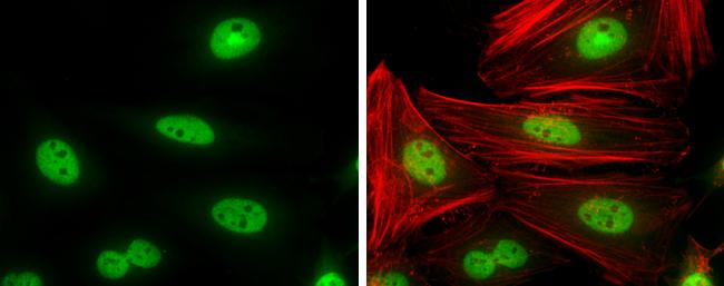 Cyclin T1 Antibody in Immunocytochemistry (ICC/IF)