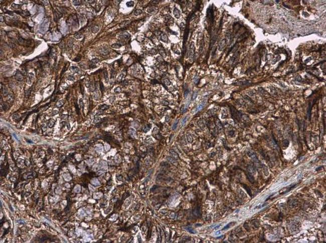 CD59 Antibody in Immunohistochemistry (Paraffin) (IHC (P))