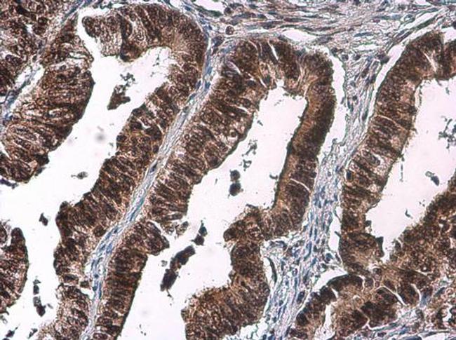 Phospho-CDK2 (Thr160) Antibody in Immunohistochemistry (Paraffin) (IHC (P))