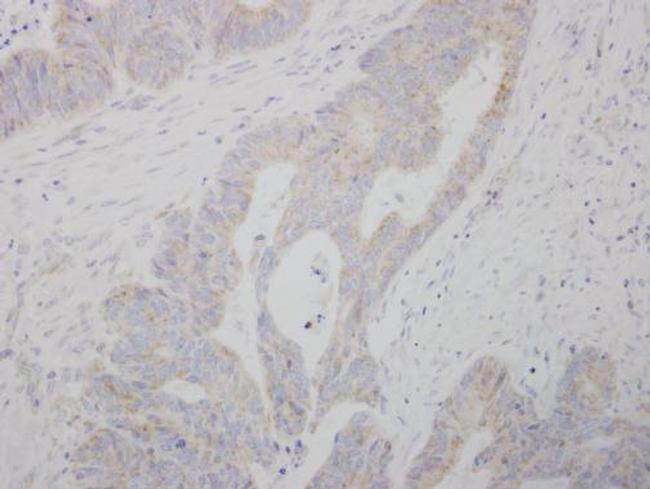 COMT Antibody in Immunohistochemistry (Paraffin) (IHC (P))