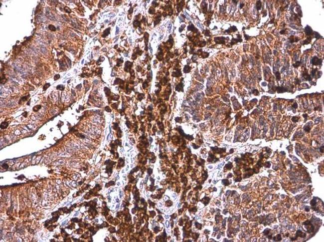 CYBA Antibody in Immunohistochemistry (Paraffin) (IHC (P))