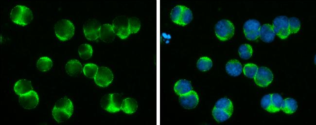 DOCK2 Antibody in Immunocytochemistry (ICC/IF)