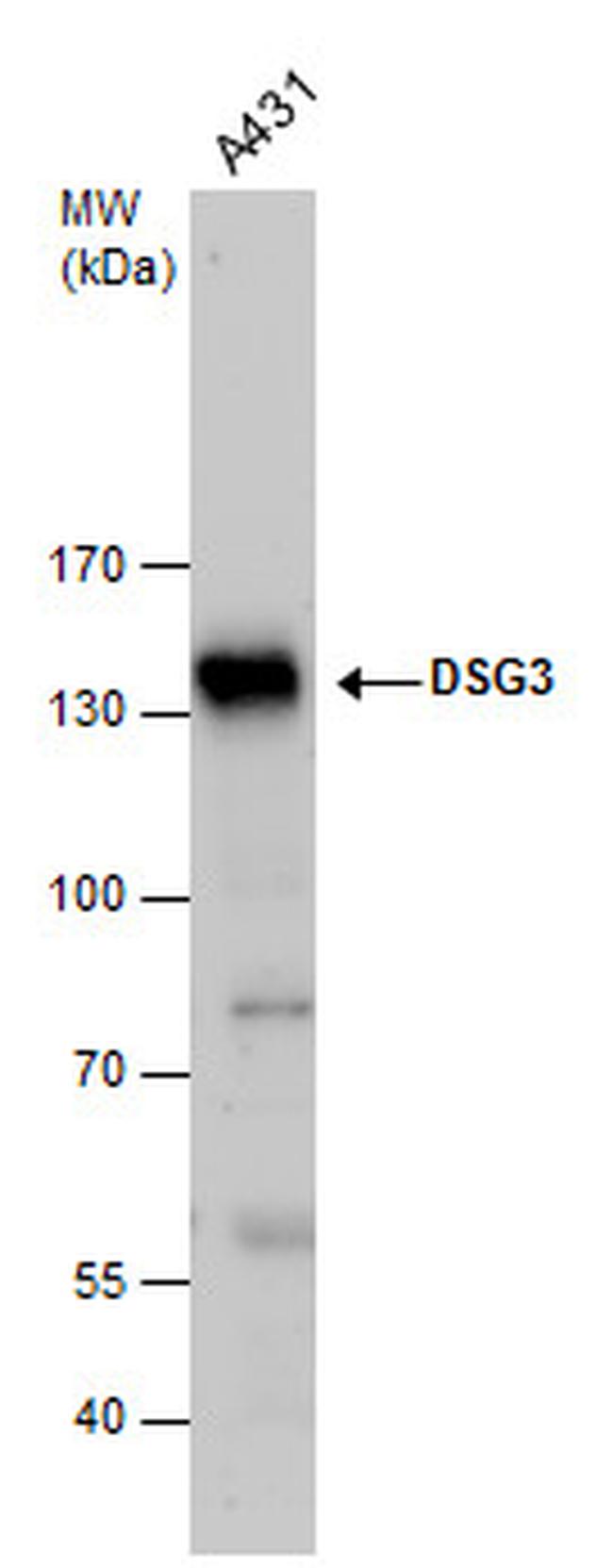 Desmoglein 3 Antibody in Western Blot (WB)