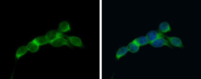 eIF4E Antibody in Immunocytochemistry (ICC/IF)