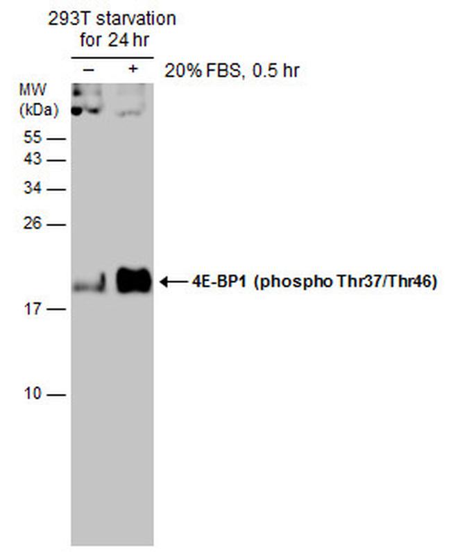 Phospho-4EBP1 (Thr37, Thr46) Antibody in Western Blot (WB)