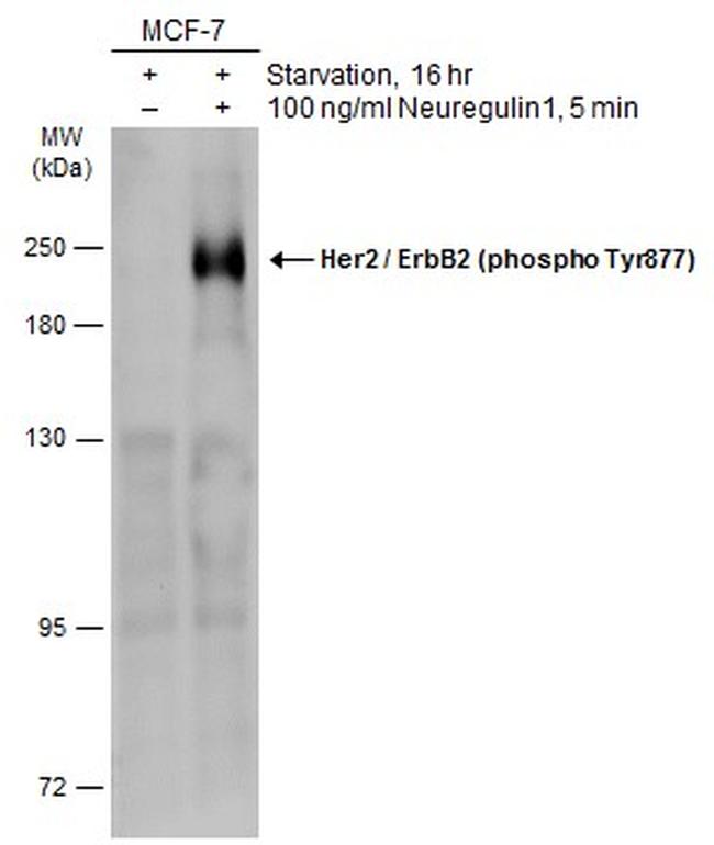 Phospho-ErbB2 (HER-2) (Tyr877) Antibody in Western Blot (WB)