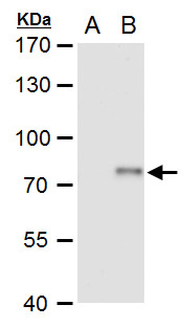 XPD Antibody in Western Blot (WB)