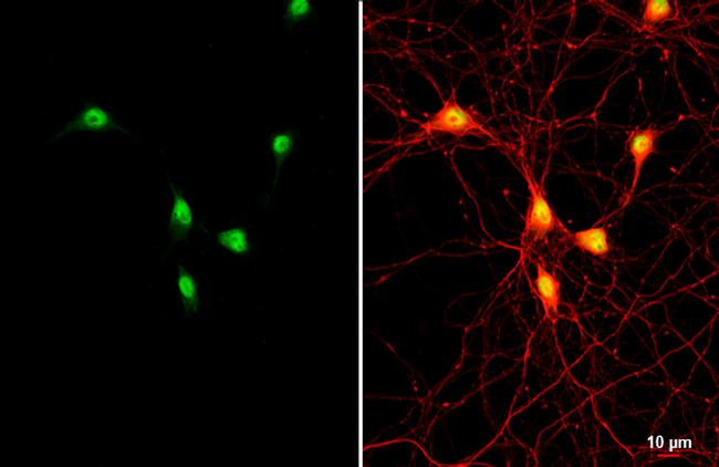 ETV1 Antibody in Immunocytochemistry (ICC/IF)