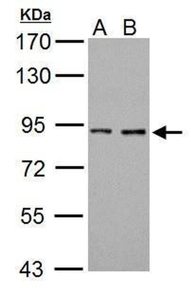 Prothrombin Antibody in Western Blot (WB)