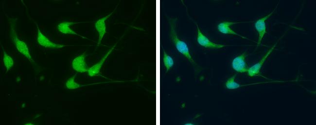 FGF14 Antibody in Immunocytochemistry (ICC/IF)