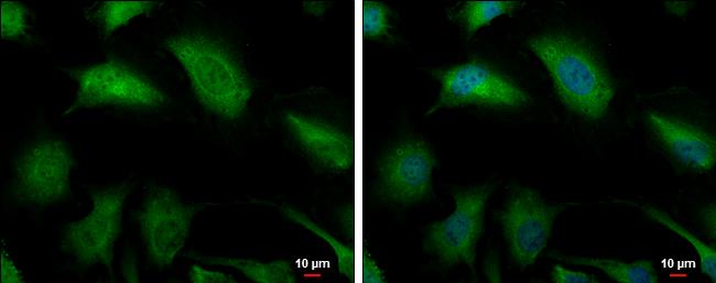 GLO1 Antibody in Immunocytochemistry (ICC/IF)