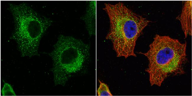 GSTP1 Antibody in Immunocytochemistry (ICC/IF)