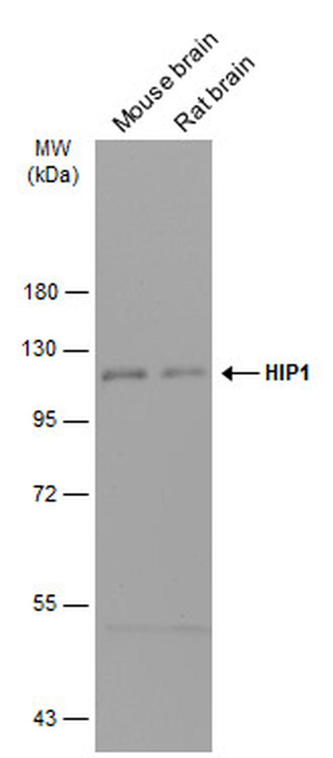 HIP1 Antibody in Western Blot (WB)