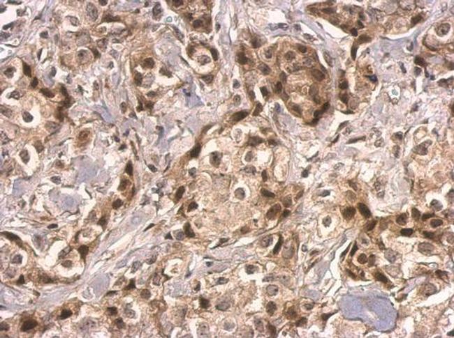 HMGB2 Antibody in Immunohistochemistry (Paraffin) (IHC (P))