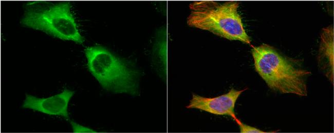 HSP27 Antibody in Immunocytochemistry (ICC/IF)