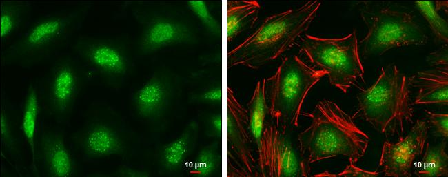 ID1 Antibody in Immunocytochemistry (ICC/IF)