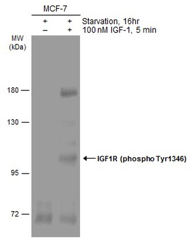 Phospho-IGF1R beta (Tyr1316) Antibody in Western Blot (WB)