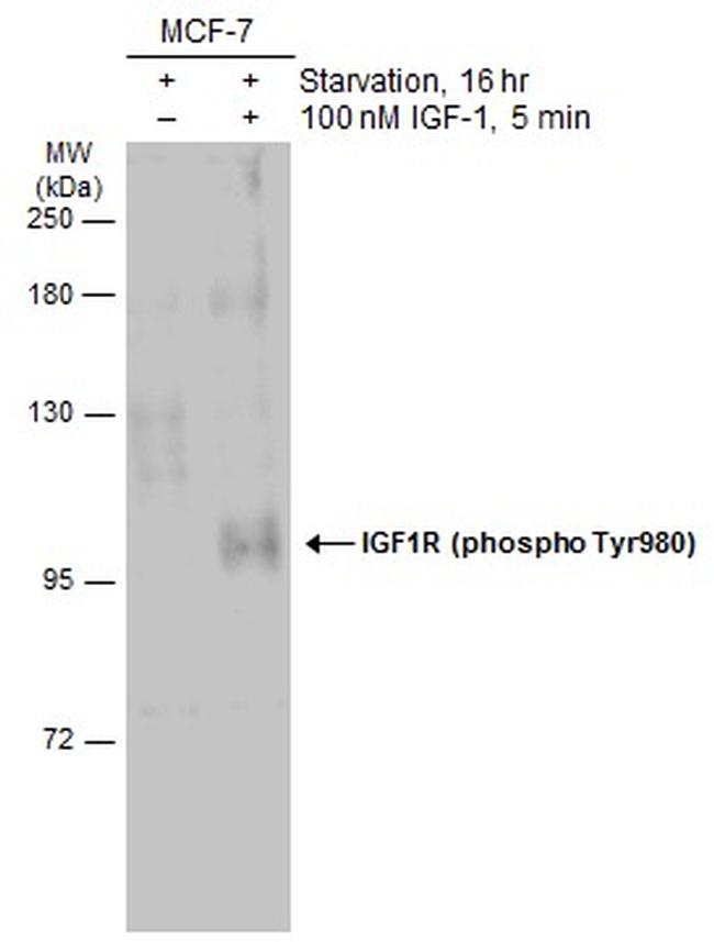 Phospho-IGF1R beta (Tyr980) Antibody in Western Blot (WB)