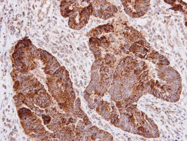 CD171 (L1CAM) Antibody in Immunohistochemistry (Paraffin) (IHC (P))