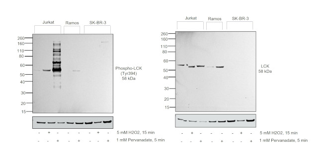 Phospho-LCK (Tyr394) Antibody in Western Blot (WB)